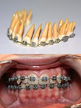 110_50_spange_modell