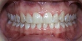 110_30_front